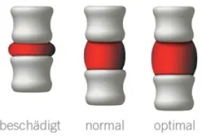 SpineMED Behandlung